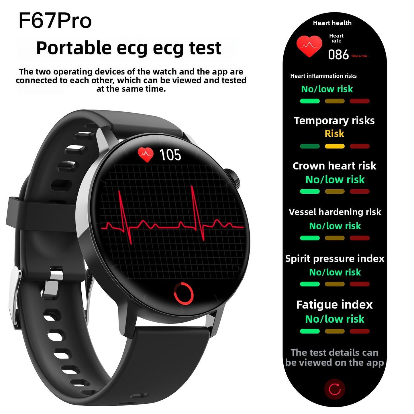 Smartwatch de Salud 1.41” – Fitness Tracker con Ritmo Cardíaco, Oxígeno en Sangre, Presión Arterial y Sueño